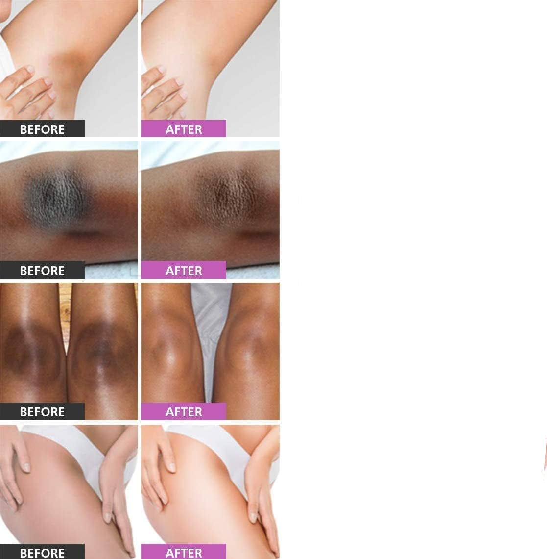 AICHUN BEAUTY 3 DAY Quick Whitening Cream 120ml Whitening Complex Collagen Milk Face & Body Cream Power Antioxidants