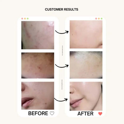 Beauty Of Joseon Sunscreen 10gm Rice + Probiotics Spf 50+ Pa++++